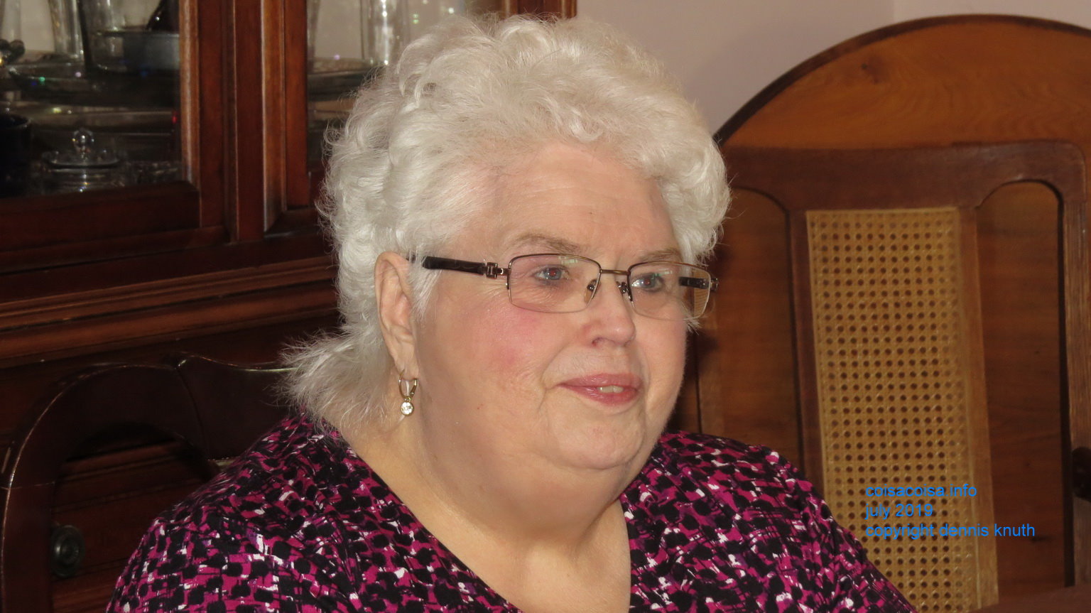 Glow has a beutiful complexion for being 75 years old